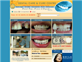 Screenshot of Dental Implants India